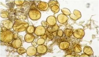 Cultured VAM fungi